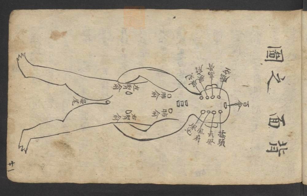 全抄小儿推拿广意(第33页)