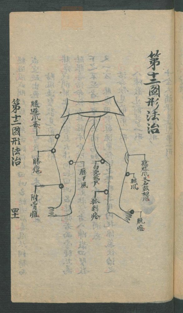 外科图形法治(第101页)