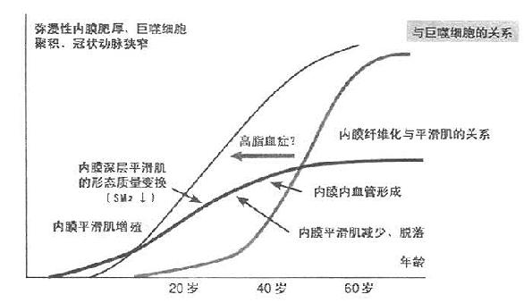 内膜平滑肌增殖和巨噬细胞集积对冠状动脉的影响