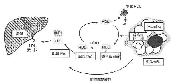 巨噬细胞脱泡沫化与胆固醇的逆转运机制示意图