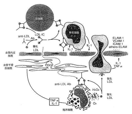 动脉硬化疾病机制中的免疫反应（假说）