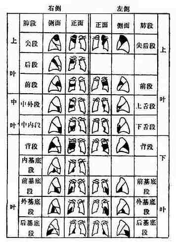 支气管肺段在正、侧位胸片分布图