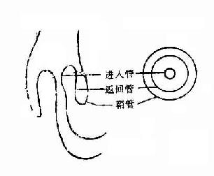 肠套迭层次示意图