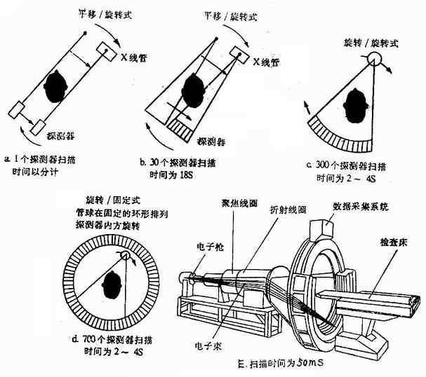 第1－5代（CT）扫描方式