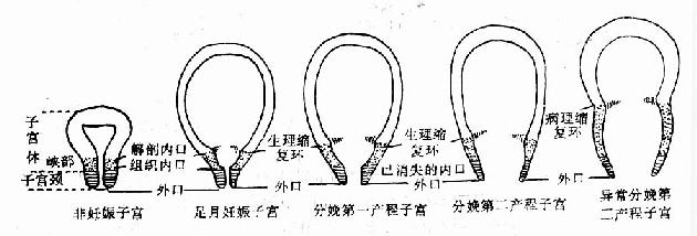 宫颈扩张及子宫下段形成