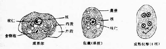 结肠内阿米巴