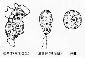 齿龈阿米巴