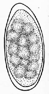 东方毛圆线虫卵
