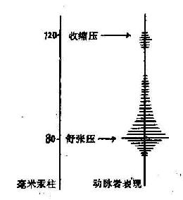 收缩压及舒张压示意图