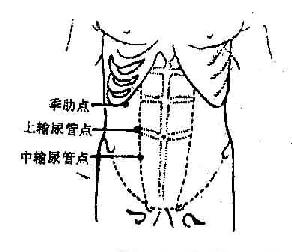 肾、输尿管疾病压痛点示意图