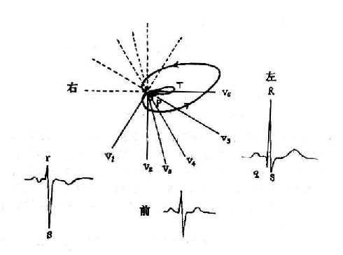 横面心向量环与胸导联心电图的关系