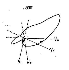 左室肥厚时QRS向量数及T数图