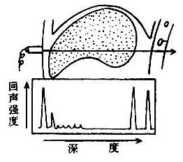 A型回声图示意图回声图