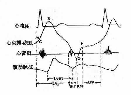 心动周期内左心室各种时相的测定示意图