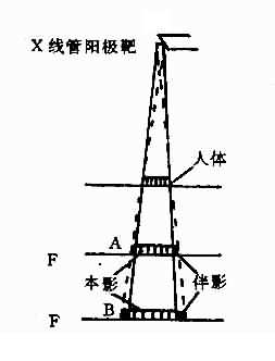 X线管阳极靶对X线投影的（放大与晕影）焦点面使X线投影放