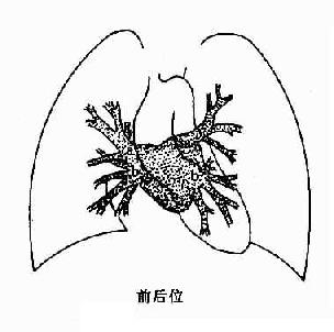 正常肺静脉、左心房造影示意图